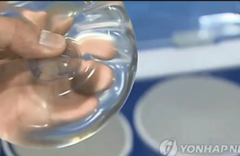 “MFDS advises screening for breast implant rupture prior to breastfeeding.”